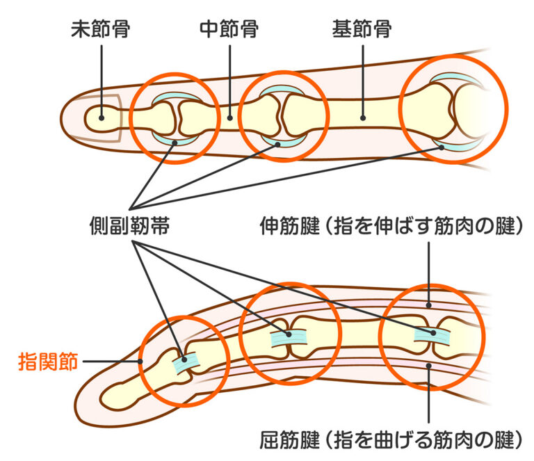 突き指とは？「指をぶつけたら腫れて痛い…」それ、靱帯や腱が傷ついているかも？ | ササモト整形外科